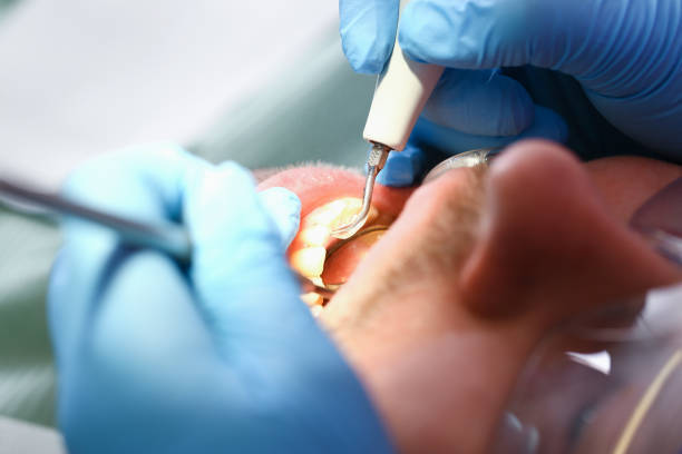 Best Holiday Emergency Dentist in Urbana, IL