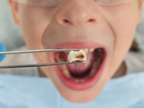 Best Pediatric Emergency Dentist in Urbana, IL